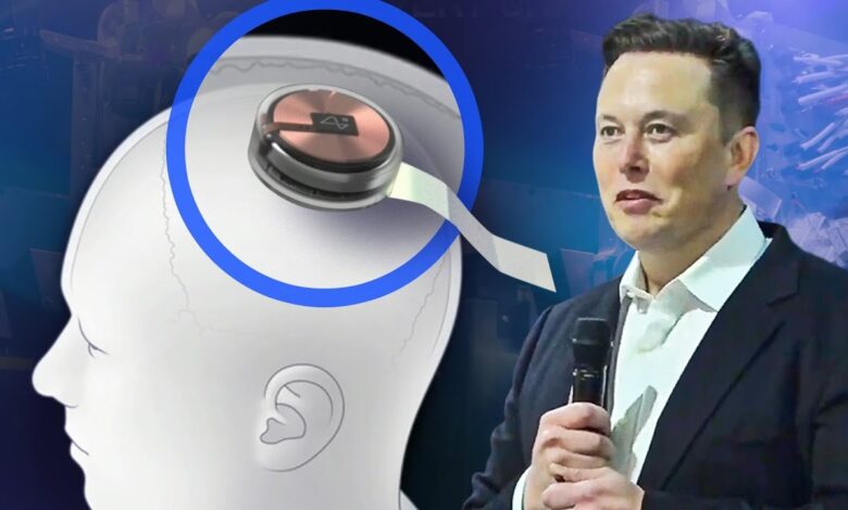 Neuralink musk